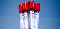 alt="donate blood plasma"